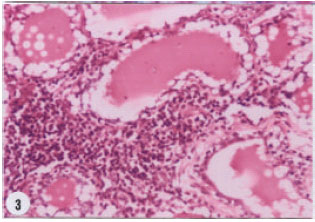 Image for - Some Clinico and Histopathological Changes in Female Goats Experimentally Exposed to Dioxin