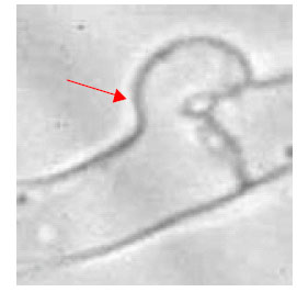 Image for - Isolation of Clinical Strains of Pseudomonas aeruginosa Harboring Different Plasmids