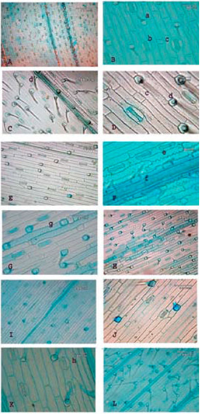 Image for - A Morphological and Anatomical Study of an Annual Grass Eremopyrum (Poaceae) in Iran