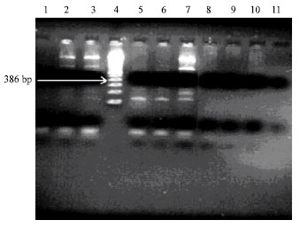 Image for - Detection of Legionella pneumophila by PCR-ELISA Method in Industrial Cooling Tower Water