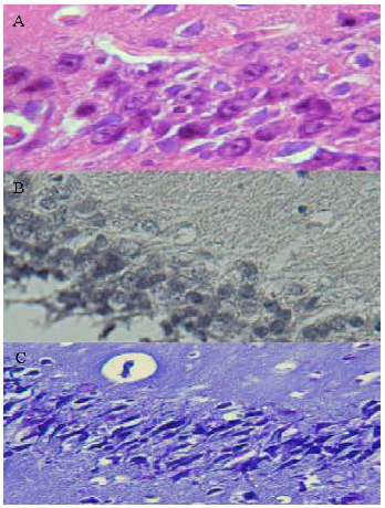 Image for - Effects Modification of Iron Hematoxylin on Neuron Staining