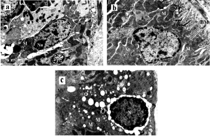 Image for - Acute Effect of Cadmium Treatment on the Kidney of Rats: Biochemical and Ultrastructural Studies