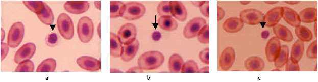 Image for - Blood Cell Characteristics, Hematological Values and Average Daily Gained Weight of Thai Indigenous, Thai Indigenous Crossbred and Broiler Chickens