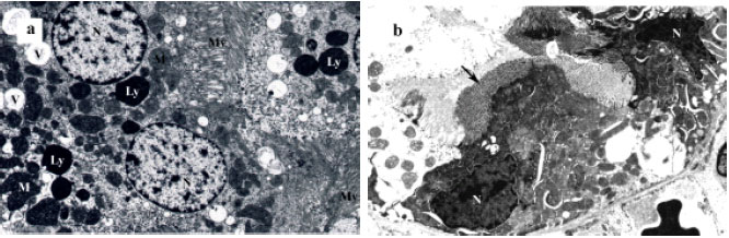 Image for - Acute Effect of Cadmium Treatment on the Kidney of Rats: Biochemical and Ultrastructural Studies