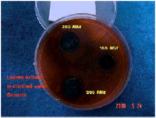 Image for - Antibacterial Activity of the Broad Bean Extracts on Resistant Bacteria