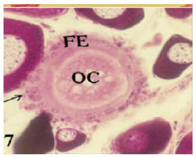 Image for - Common Forms of Atresia in the Ovary of Some Red Sea Fishes During Reproductive Cycle