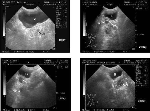 Image for - Time of Initial Detection of Fetal Structures and Anatomic Differentiation by Using B-Mode Ultrasound Examination in Bitches