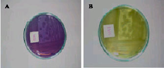 Image for - Isolation of a Novel Mutated Strain of Xanthomonas  campestris for Xanthan Production Using Whey as the Sole Substrate