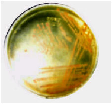 Image for - Evaluation of a New CHROMagar Medium for Detection of Methicillin-Resistant Staphylococcus aureus