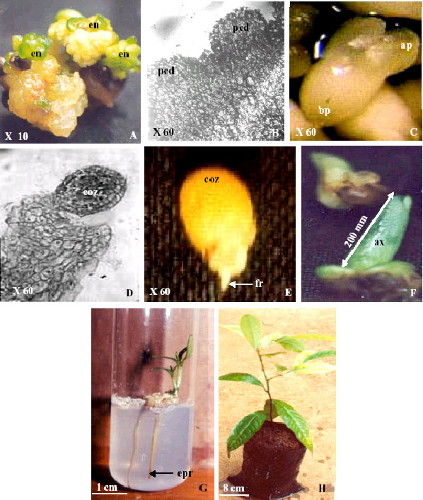 Image for - In vitro Regeneration of Irvingia gabonensis by Somatic  Embryogenesis