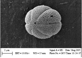 Image for - Anatomical and Pollen Ornamentation Study on Hymenocrater species in North East of Iran