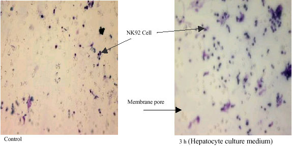 Image for - Assessment of NK Cells Response to Hepatocyte Derived Chemotactic Agents