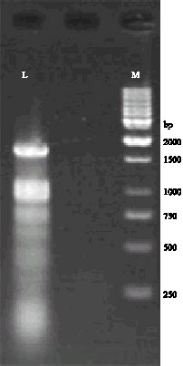 Image for - Rapid Detection of Potato Y potyvirus in Potato Farms of Kermanshah using RT-PCR Amplification of the P1- Protease Gene and Its Cloning