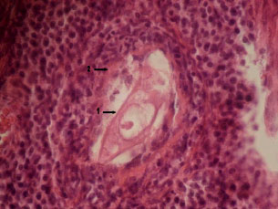 Image for - Role of Nitric Oxide on the Generation of Atretic Follicles in the Rat Ovaries