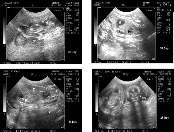 Image for - Time of Initial Detection of Fetal Structures and Anatomic Differentiation by Using B-Mode Ultrasound Examination in Bitches