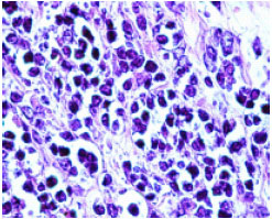 Image for - Lymphoma in Syrian Hamster