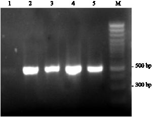 Image for - The Prevalence of CagA and CagE Genes in Helicobacter pylori Strains Isolated from Different Patient Groups by Polymerase Chain Reaction