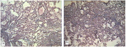 Image for - The Role of Strain Variation in BAX and BCL-2 Expression in Murine Bleomycin-Induced Pulmonary Fibrosis