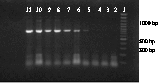Image for - Detection and Frequency of Stx2 Gene in Escherichia coli O157  and O157:H7 Strains Isolated from Sheep Carcasses in Shiraz-Iran