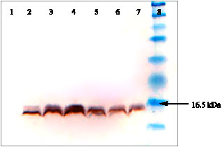 Image for - Controlled Expression of Cholera Toxin B Subunit from Vibrio holerae in Escherichia coli