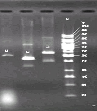 Image for - Rapid Detection of Potato Y potyvirus in Potato Farms of Kermanshah using RT-PCR Amplification of the P1- Protease Gene and Its Cloning