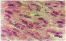 Image for - Histopathological Effect of Enalapril Maleate on Fetal Heart in Rat