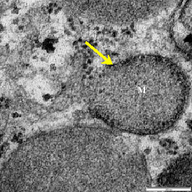 Image for - Morphological Alteration in Mitochondria Following Diclofenac and  Ibuprofen Administration