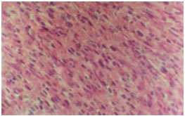 Image for - Histopathological Effect of Enalapril Maleate on Fetal Heart in Rat