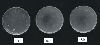 Image for - Method and Quantity of Liquid Formulation of Phosphobacteria Required for Seed Inoculation