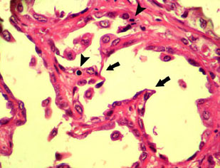 Image for - An Abattoir Study on Hepatic Tumors of Sheep