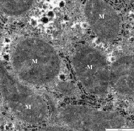 Image for - Morphological Alteration in Mitochondria Following Diclofenac and  Ibuprofen Administration