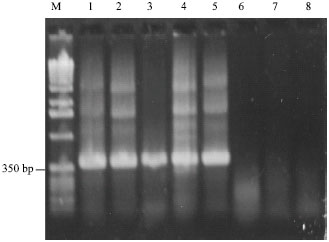 Image for - Rapid Detection of Borrelia burgdorferi Strains by Nested Polymerase Chain Reaction