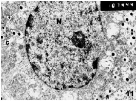 Image for - Histological and Electron Microscopic Studies of the Effect of β-Carotene on the Pancreas of Streptozotocin (STZ)-Induced Diabetic Rats