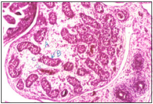 Image for - Gemcitabine Impacts Histological Structure of Mice Testis and Embryonic Organs