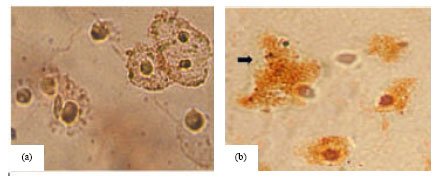 Image for - Effect of Bone Morphogenetic Protein-2 on Normal and Osteoarthritic Human Articular Chondrocytes