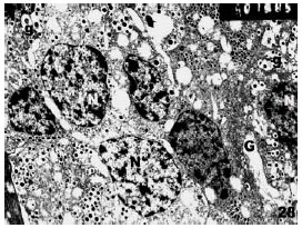 Image for - Histological and Electron Microscopic Studies of the Effect of β-Carotene on the Pancreas of Streptozotocin (STZ)-Induced Diabetic Rats