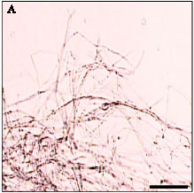 Image for - Detection of a Histidine Kinase mRNA in Extraradical Mycelium of Pisolithus tinctorius Induced by the Plant Metabolites