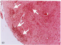 Image for - Effect of Ethanol Extract of Saffron (Crocus sativus L.) on the Inhibition of Experimental Autoimmune Encephalomyelitis in C57bl/6 Mice