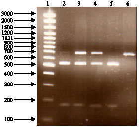 Image for - CYP2C9 Gene Analysis of Some Iranian Hypersensitive Patients to Warfarin