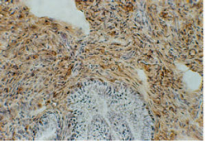 Image for - An Immunohistochemical Study of Beta1 Integrin Molecules (VLA-4, VLA-5, VLA-6) in All Endometrial Compartments of Fertile and Infertile Women in Ahwaz-Iran