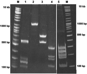 Image for - Identification of Panulirus homarus Puerulus Larvae by Restriction Fragment Length Polymorphism of Mitochondrial Cytochrome Oxidase I Gene