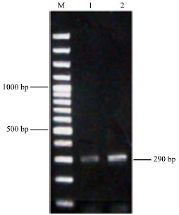 Image for - Non-Radioactive Labeled Probe Preparation for hbs Gene Detection
