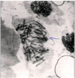 Image for - Cytological and Toxicological Properties of a Decoction Used for Managing Tumors in Southwestern Nigeria