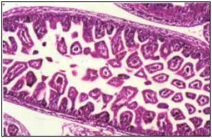 Image for - Gemcitabine Impacts Histological Structure of Mice Testis and Embryonic Organs