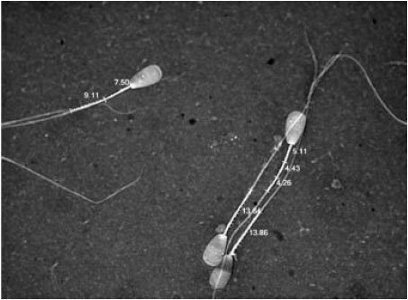Image for - Mid-piece Length of Spermatozoa in Different Cattle Breeds and its Relationship to Fertility