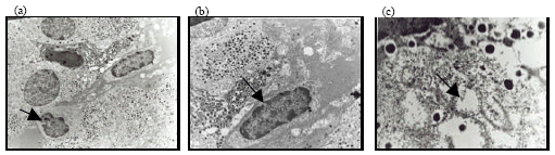 Image for - Pancreatic Islet Beta Cell Protective Effect of Oral Vanadyl Sulphate in Streptozotocin-induced Diabetic Rats, an Ultrastructure Study