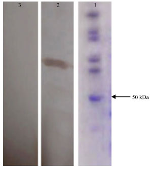 Image for - Production of Recombinant Streptokinase in E. coli and Reactivity with Immunized Mice