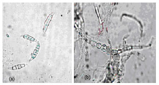Image for - RAPD-PCR Analysis of Genetic Variation among Isolates of Fusarium graminearum and Fusarium culmorum from Wheat in Adana Turkey