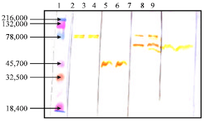 Image for - Virulence of Environmental Stenotrophomonas maltophilia Serologically Cross-reacting with Shigella-specific Antisera