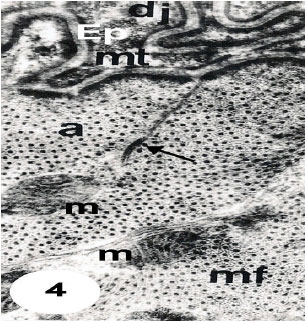 Image for - Ultrastructural Study of Muscles Fibers in Tick Hyalomma (Hyalomma) anatolicum anatolicum (Ixodoidea: Ixodidae)